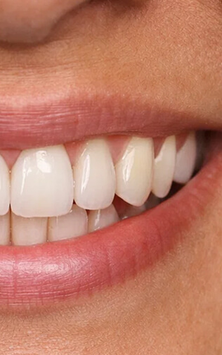 Después rehabilitación